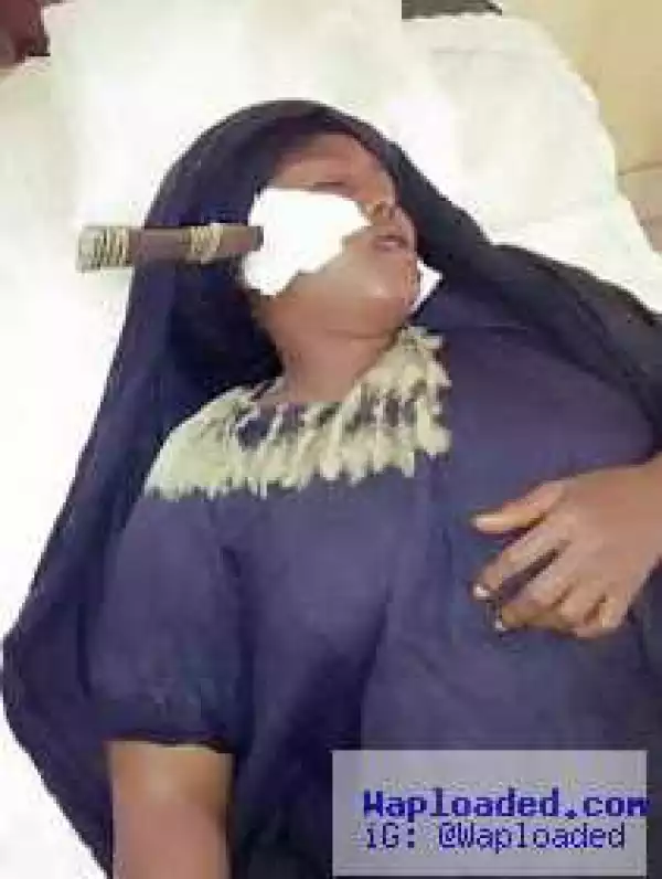 Woman stabbed on the cheek by her husband, doctors yet to remove the knife (photos)